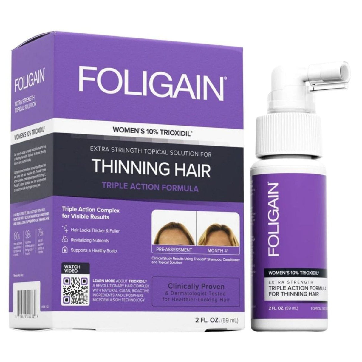Foligain Triple Action Complete Formula For Thinning Hair For Women - 59 ml
